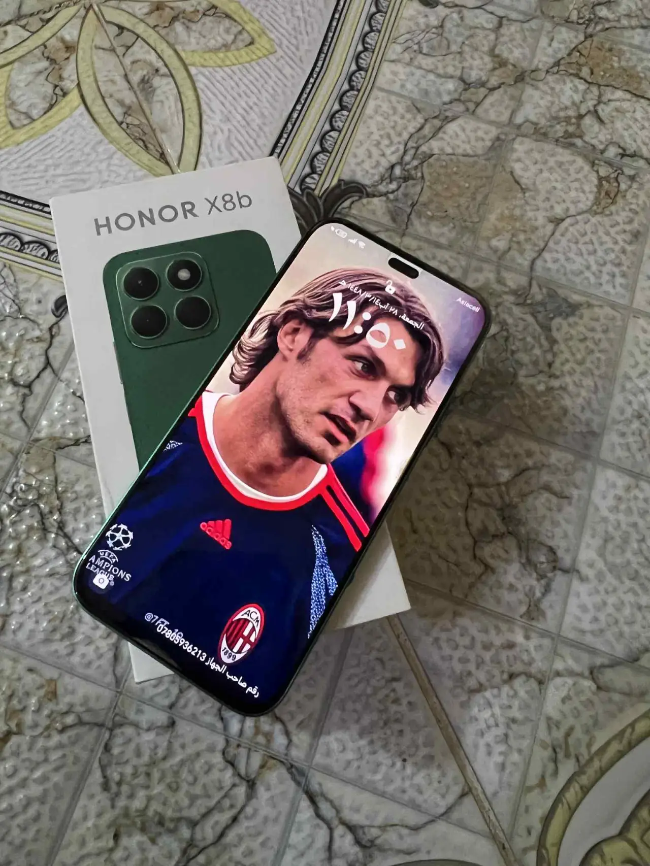 Honor X8b — 225,000 د.ع